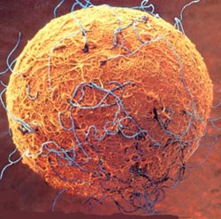 Implantation of Adult Stem Cells in Cuba Implantation of Adult Stem Cells in Cuba